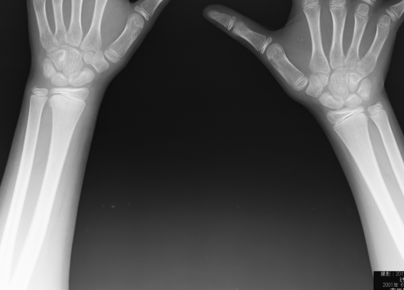 保谷のおおぞら整骨院 21時まで診療。保谷駅徒歩５分