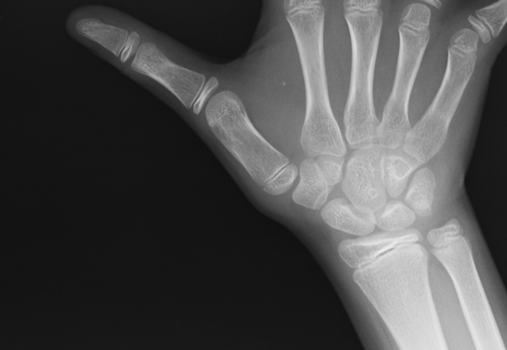 保谷のおおぞら整骨院 21時まで診療。保谷駅徒歩５分