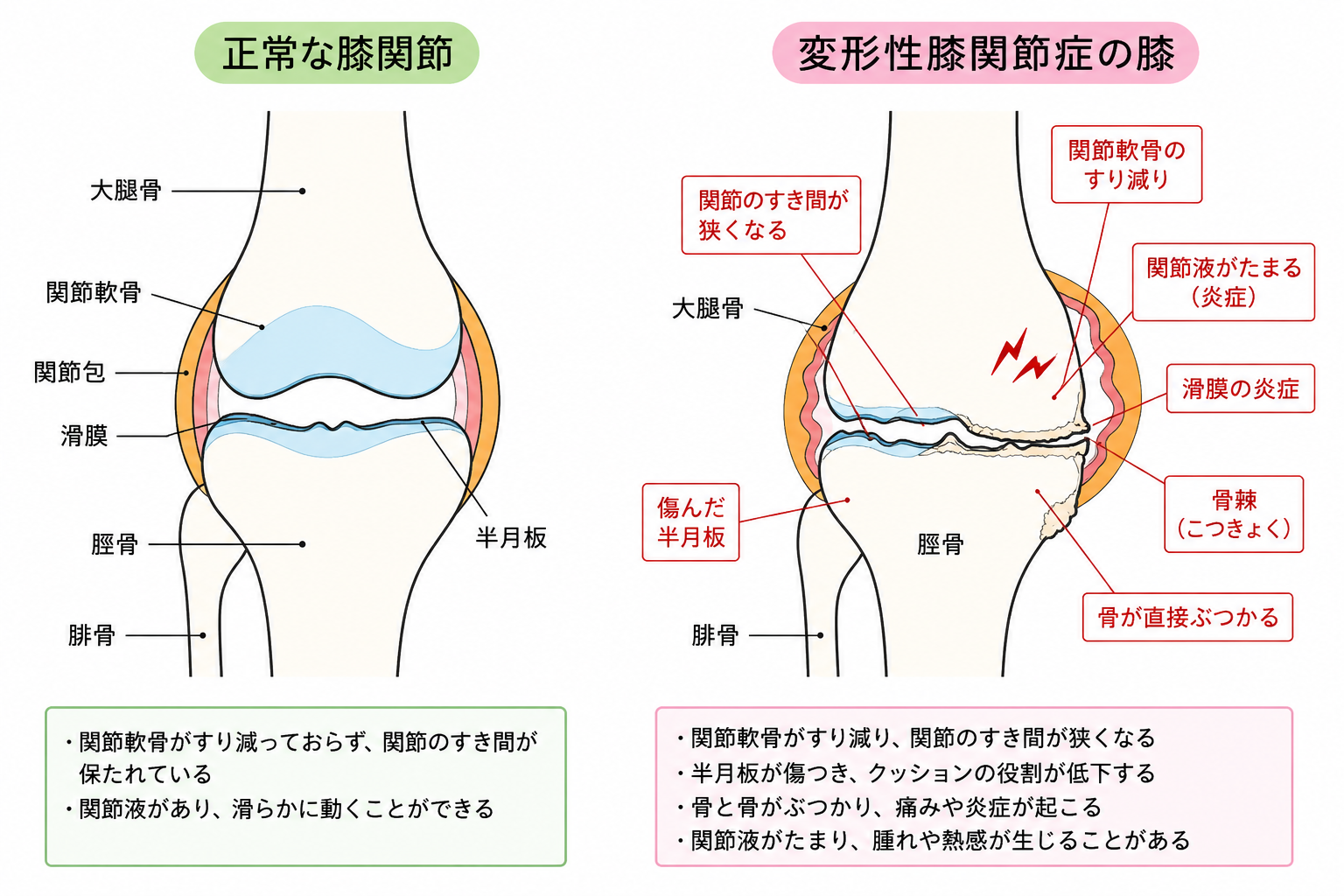 保谷のおおぞら整骨院 21時まで診療。保谷駅徒歩５分